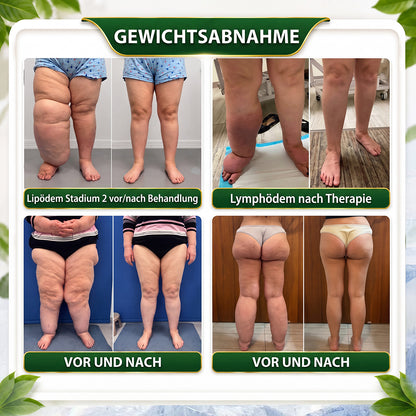🎁 Herzlichen Glückwunsch! Du hast das 𝑮𝒓𝒆𝒆𝒏𝑭𝒆𝒆𝒍®-Überraschungsangebot mit 80 % Rabatt freigeschaltet. Dies ist ein exklusives Angebot – lass es dir nicht entgehen!